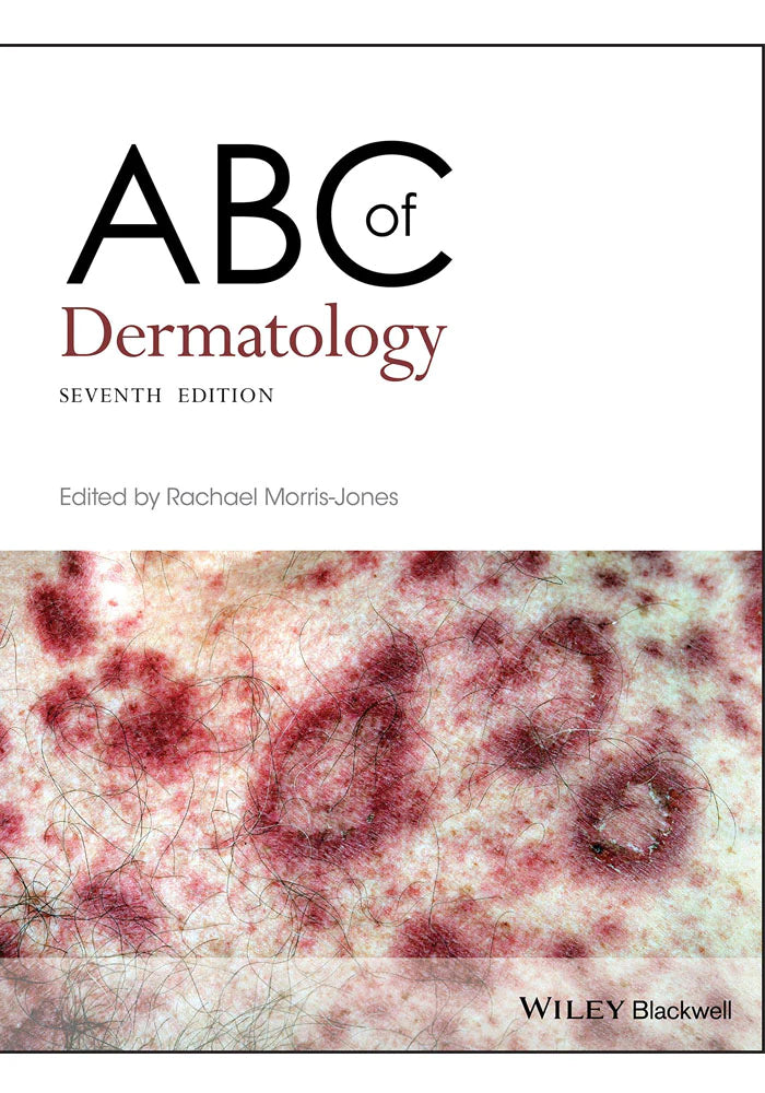 ABC Of Dermatology