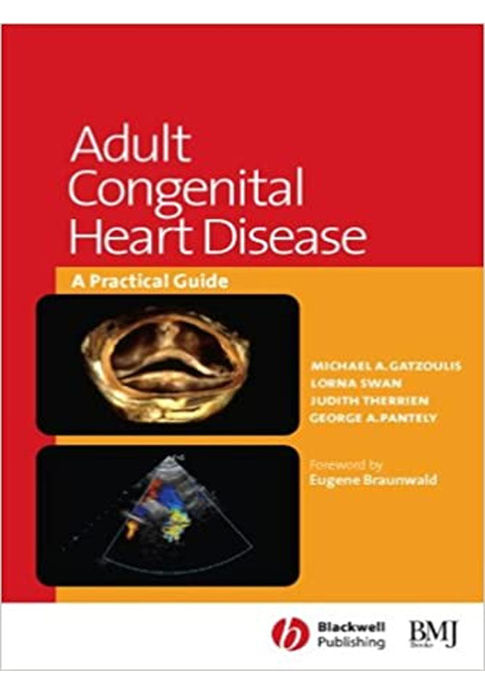 Adult Congenital Heart Disease A Practical Guide