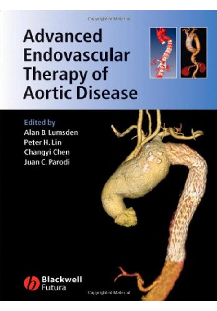 Advanced Endovascular Therapy of Aortic Disease