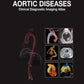 Aortic Diseases Clinical Diagnostic Imaging Atlas
