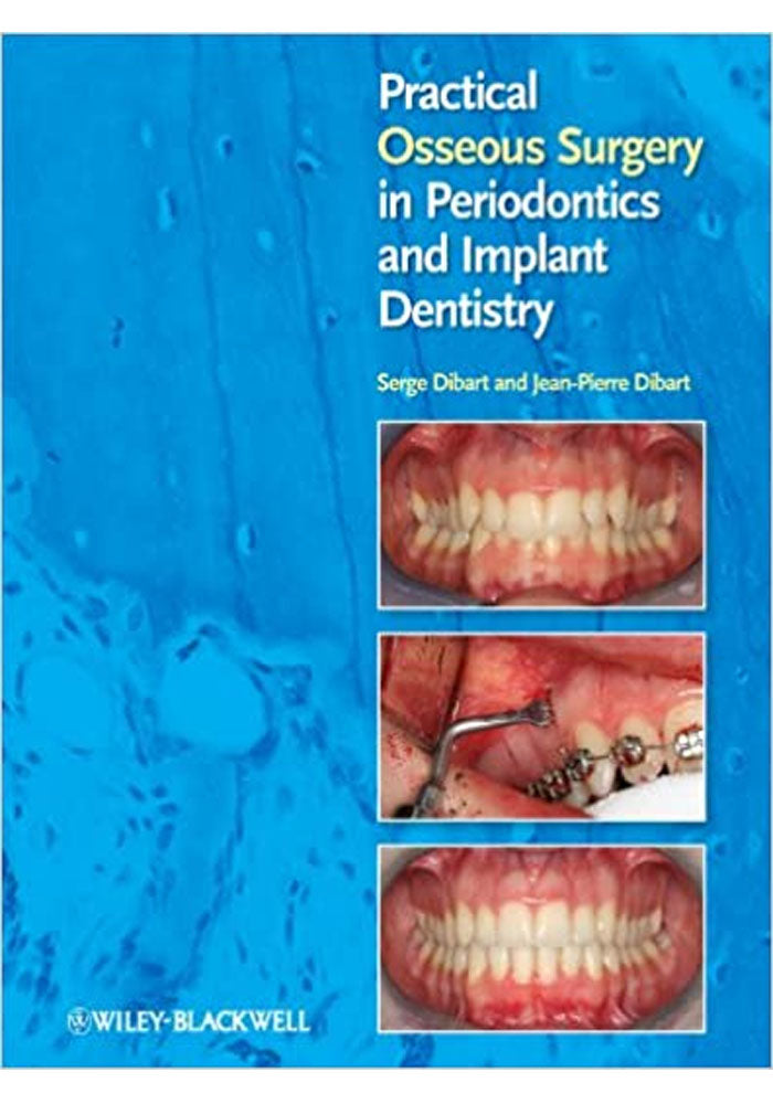 Practical Osseous Surgery in Periodontics and Implant Dentistry 1st Edition