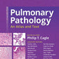 Pulmonary Pathology: An Atlas and Text 3rd Edition, Kindle Edition